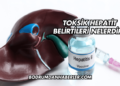 Toksik Hepatit Belirtileri Nelerdir?