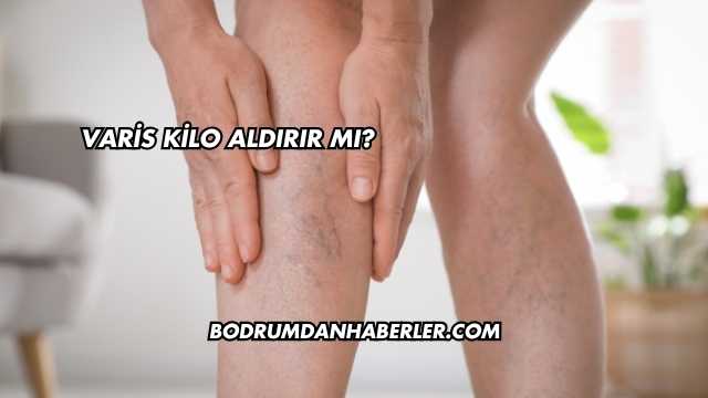 Varis Kilo Aldırır mı?